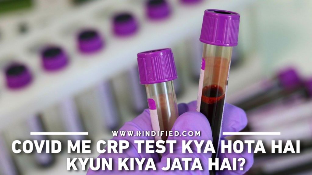 CRP Test in COVID, COVID me CRP Test, CRP Test Kya Hai, COVID ke Liye CRP Test, CRP Test in COVID in Hindi, CRP Test Positive Means in Hindi, CRP Test Kya Hota Hai, Coronavirus CRP Test, CRP Test ka Matlab