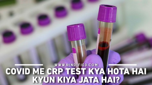CRP Test in COVID, COVID me CRP Test, CRP Test Kya Hai, COVID ke Liye CRP Test, CRP Test in COVID in Hindi, CRP Test Positive Means in Hindi, CRP Test Kya Hota Hai, Coronavirus CRP Test, CRP Test ka Matlab