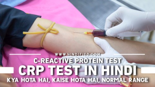 CRP Test, CRP Test Full Form, CRP Test in Hindi, C-Reactive Protein Test, CRP Test Kya Hota Hai, CRP Test Kya Hota hai in Hindi, CRP Test ka Matlab, CRP Test Kya Hai, CRP Test Kis Liye Hota Hai, CRP Test Kyu Kiya Jata Hai, CRP Test ki Normal Range, CRP Test Kaise Hota Hai, CRP Levels, CRP Test Kyu Karaya Jata Hai, Kaise Kiya Jata Hai CRP Test, CRP Test Ka Hindi Meaning